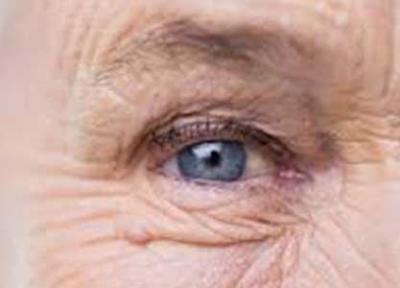 چین و چروک صورت را با این خوراکی کاهش دهید