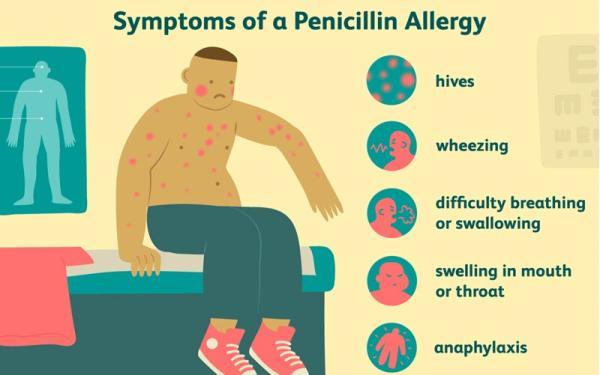 آلرژی به پنی سیلین چه علائم و عوارضی دارد؟